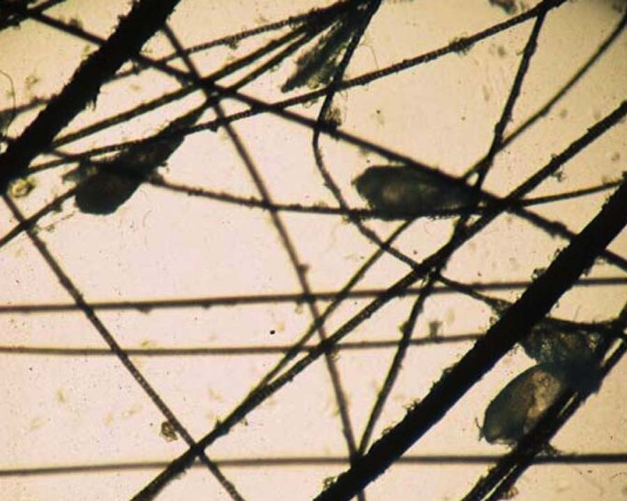 Cheyletiella mite eggs attached to hairs, seen under a microscope