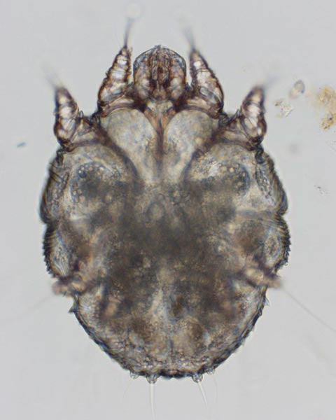 Sarcoptic scabei mange mite as seen under microscope