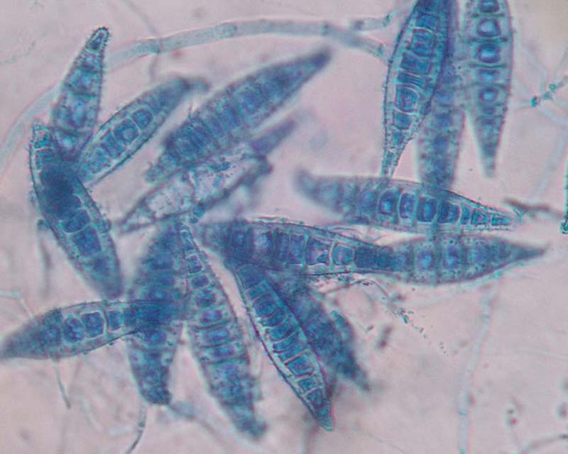 Ringworm species Microsporum canis macroconidia stained blue and seen under a microscope