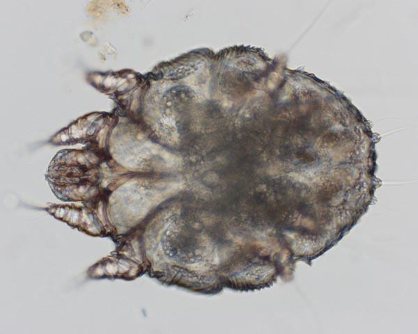 Sarcoptic scabei mange mite as seen under microscope